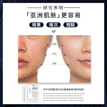 雅萌MAX二代旗舰版射频美容仪怎么样？牌子好吗？