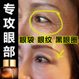 泊泉雅二裂酵母奢润精华眼霜小棕瓶保湿孕妇补水细纹黑眼圈眼袋脂肪粒 五瓶装