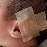 艾妮心新生婴儿儿童爱美耳夹硅胶耳廓贴非耳朵矫正器耳型环缩耳垂耳隐耳 硅胶贴6盒