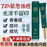 同仁堂祛痘膏去痘痘和痘疤痘坑修复初高中生男女学生青春痘20g