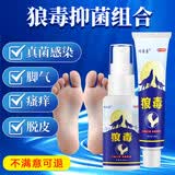祥醫堂狼毒脚气喷剂60ml+20g*1脚臭止痒脱皮烂臭脚丫脚趾缝溃烂水泡型
