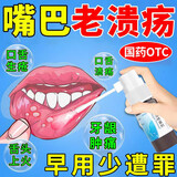 口腔溃疡特药效 上火清火的药 口疮生疮舌头起泡唇角起泡嘴巴溃烂红肿疼痛舌炎口腔溃疡喷剂 口洁喷雾剂 1盒装【口腔溃疡】