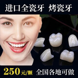 全瓷牙冠威兰德二氧化锆爱尔创泽康3m拉瓦全瓷牙根管治疗镶牙补牙义齿假牙齿贴面片全瓷牙套二氧化锆烤瓷牙 威兰德全瓷牙