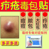蕴祥火疖子非拔毒膏疖子非拔脓贴疖疮贴毛囊发炎脓包拔毒贴硬块坐板疮 【1疗程】共5贴