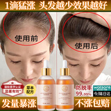 韩方五谷防脱育发液生固发增长密男女头发际线护发理毛囊营养精华100ml