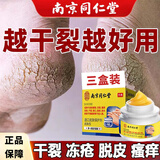 皲裂膏脚裂后跟干裂开裂膏手脚脱皮冻疮防冻防裂膏60g 三盒装