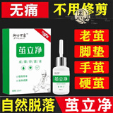 【官方药房店】茧立净去老茧子手脚厚茧立净御圣世家手足部脚钉硬皮脚茧子脚护理脚垫旗艦 【1瓶】 茧立净【一盒装】