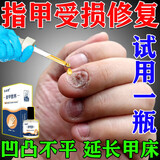 指甲生长液甲床快速生长指甲营养液修复甲肉甲床分离受损再生指甲凹凸不平分层 单瓶装【一盒少量试用】