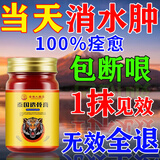 泰国金老虎水肿消肿专用膏药利尿消水肿浮肿老年人水肿下肢水肿腿脚肿消肿药 特效膏1盒【水肿当天消】