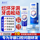 益口宁医用口腔防蛀脱敏膏龋齿封闭窝沟点间隙牙釉质耐酸蚀性含氟膏 1盒【体验装】
