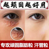 韩鹭南京同仁堂眼霜脂肪粒黑眼圈眼细纹护肤品50g 3盒周期装【90%客户的选择】