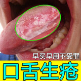 药健百瑞口腔扁平苔藓专用可搭药口舌生疮舌炎烂舌头白斑口腔溃疡修复液 【买二发三】三盒只要两盒钱