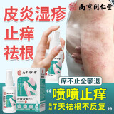 南京同仁堂湿疹止痒皮肤瘙痒去痒皮炎湿疹皮癣真菌感染湿疹凝胶药顽根成人 瘙痒止痒喷剂*30ml