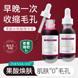 臻羞水杨酸果酸精华液刷收缩酸淡化闭口粉刺黑头痘毛孔粗大非面部护肤 30ml【1瓶装】轻度闭口粉刺