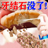 牙结石溶解液洗牙齿去黄牙结石去除器牙垢牙结石清除强力漱口水 单盒装【牙结石克星】