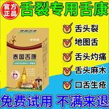 舌头裂纹有齿痕舌苔白厚舌裂舌头裂纹干裂舌炎舌头上火舌苔发白黄口干口苦口臭非药喷剂 单盒装