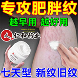 肥胖纹修复男女士肥胖纹神器消的除大腿肚子皱纹生长纹妊娠纹皮肤断裂皮肤松弛精华霜 【单盒体验装】祛除神器