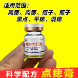 点痣膏水无痕 脸部去痣点痣膏官方正i品祛斑点斑专用膏(药监备案) 一盒普通装【点痣膏】