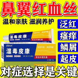 鼻翼脂溢性皮炎两侧发红酒糟鼻专用膏草莓鼻红鼻子红血丝干燥起皮角质层薄修复膏 一支装【少量适用】