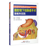 腹腔镜下结肠癌手术策略和实践
