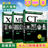 正版全新  CT+X线+MRI读片指南套装 影像读片从入门到精通 影像学诊断图谱影像解剖学图谱