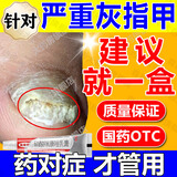 达克宁软膏硝酸咪康唑乳膏灰指甲效特非进口专用的药手脚指甲真菌感染脱甲坏甲增厚药膏甲癣专用药正品灰甲药 1盒达克宁【国药认证】灰指甲特药效专用的药 当日发货
