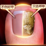 LZJV美国专研智能灰指甲光疗机杀真菌灯美甲灯去坏甲激光机仪器正品 抑菌药水【搭配使用效果更佳】