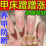 指甲修复生长液促进生长甲床分离肉包甲矫正手脚指甲变空增厚防倒刺竖纹护理去死皮边缘修复指甲液 【单盒体验装】指甲快速生长
