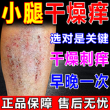 腿上干燥起皮小腿皮肤痒冬天皮肤干燥腿部起红斑红点疙瘩止痒抑菌 一盒装【标准装】