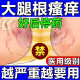 股癣i药膏大腿内侧阴囊私处瘙痒股藓真菌感染皮肤用药非处方湿疹潮湿瘙痒止痒去看根硝酸咪康唑乳膏男人专用 5盒【股癣反复长】巩固装