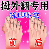 日本拇指外翻贴膏脚趾变形矫正器贴大拇矫炎疼痛拇指变形重叠大脚骨突出大拇指外翻成人儿童拇外翻矫正 【脚骨严重畸形】疗程装三送二