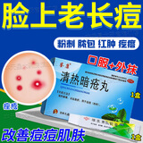 清热解毒痤疮i丸祛痘消炎痤疮专用青少年内调玫瑰痤疮硬疙瘩专用药皮肤屏障受损闭口粉刺青春痘 清热暗疮丸 1+1祛痘药膏【内服外抹专治痤疮痘】祛痘淡化痘印