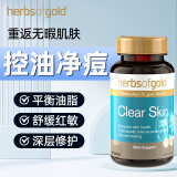 和丽康（Herbs of Gold）皮肤清洁修复片维生素B6去痘印小蓝瓶金盏花补锌痤疮Herbsofgold 抗痘大魔王1瓶（控油褪痘初效）