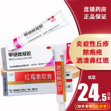 丽芙 甲硝唑凝胶可+壬二酸甲硝锉凝胶痘痘凝胶痘痘膏痤疮脸上痘痘的药炎症性丘疹 1盒+1盒红霉素软膏10g