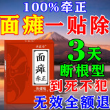 圣博康面瘫药热敷神器面瘫后遗症专用的中药贴面瘫贴膏面瘫100%牵正贴 特效膏9盒【买5送4】拒绝反复