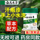 云南本草云南本草汗泡疹膏疱搭配黄氏真菌王手上起小水泡手痒脱皮手气专用 3盒装【重度】