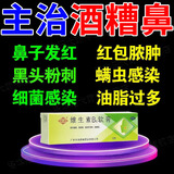 治酒糟鼻药膏】草莓鼻红鼻子酒渣鼻鼻头除螨虫 黑头粉刺草莓鼻去痤疮鼻子红肿长痘 维生素B6软膏 1盒