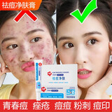 研春堂祛痘净肤膏淡化痘印痘坑男女青春痘粉刺痤疮精华凝胶改善痘痘 一支装