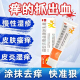 曲安奈德益康唑乳膏真菌感染脚气皮肤药抗真菌股癣专用药膏大腿内侧痒止痒抑菌皮肤瘙痒皮炎湿疹脱皮烂脚丫药 1盒【脱屑掉屑红斑瘙痒】*15.g赠棉签