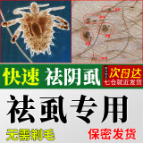 易控【阴虱专用】百部酊男女私处阴虱药成人阴虱虱卵祛除头虱虱子药 100ml 1瓶 一瓶装