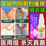 股癣i药膏大腿内侧阴囊私处瘙痒股藓真菌感染皮肤用药非处方湿疹潮湿瘙痒止痒去看根硝酸咪康唑乳膏男人专用 4盒【本品+喷剂】优先发货