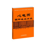 心电图图解速成讲授