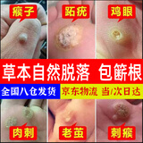 欣盛佳园去脚底老茧去硬皮专用手茧脚茧脚钉厚茧软化去除神器祛茧王抗菌液 祛茧王