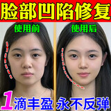 脸部凹陷填充液胶原蛋白太阳穴泪沟眼窝凹陷填充神器面部修复精华 买2赠1【三天变圆脸】 90ml
