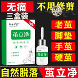 【官方药房店】茧立净去老茧子手脚厚茧立净御圣世家手足部脚钉硬皮脚茧子脚护理脚垫旗艦 【1瓶】 茧立净【三盒装】