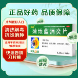 三盒装 葵花 蒲地蓝消炎片 0.31g*60片 清热解毒 抗炎消肿 咽炎片 扁桃体发炎 喉咙痛 牙龈肿痛 消炎药 咽喉炎 去火上火 常备安心