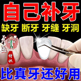 补牙3m进口树脂自己在家永补牙填充剂材料久医用堵牙洞缝宽大神器 一包装【能补10颗牙】
