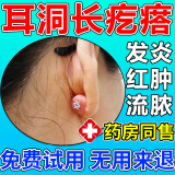 耳洞增生疙瘩护理液耳朵发炎凸起硬肉红肿流脓疤痕增生修复去除疙瘩专用医用级外用膏神器 单盒装