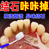 牙结石专用牙膏溶解牙石 速傚效洗牙齿去除器牙垢清除溶解液口臭 一盒装【105克】