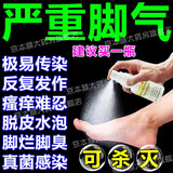 脚气药止痒脱皮烂脚丫真菌感染止痒盐酸特比萘芬喷雾剂脚趾缝溃烂痒开裂水泡脚气喷剂止痒杀菌治脚癣特用效药 1盒装【喷一喷 杀菌止痒】